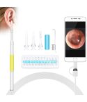 i95 3 in 1 USB Ear Scope Inspection HD 0.3MP Camera Visual Ear Spoon for OTG Android Phones & PC & MacBook, 1.75m Length Cable (Yellow + White)